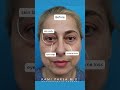 before u0026 after trifecta lift with dr. kami parsa blepharoplasty fat transfer skin tightening