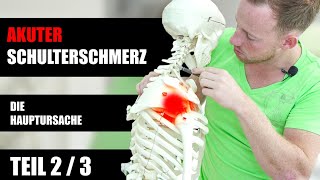 Schulterschmerz - Die Ursache liegt oft in der Halswirbelsäule! Teil 2 von 3