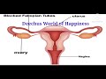 blocked fallopian tube symptoms @deechusworld