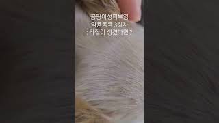 곰팡이성피부염 링웜 치료 약용샴푸3회차 각질이 생겼다면 낫는걸까?심해진걸까?