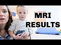 SAWYER'S AUTISM MRI RESULTS