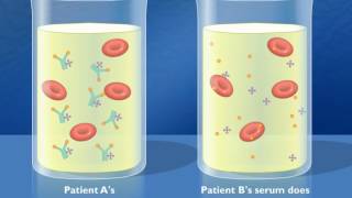 Complement Fixation Test HD Animation