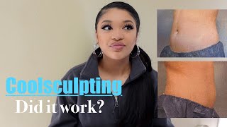 My COOLSCULPTING Results | Did it work? | *Pictures Included* | Sydney J.