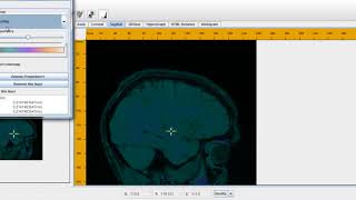 Ieee Data Mining Projects | Ieee Data Mining Thesis | Ieee Data Mining Code Projects