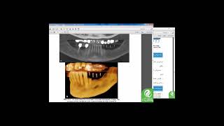 مرور سریع درس رادیولوژی دهان، فک و صورت