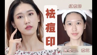 【大头菜】干货|轻松搞定新老痘印！红黑痘印、痘坑一站式解决！