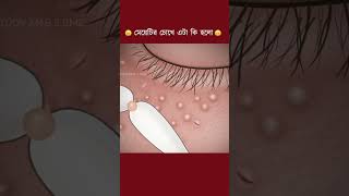 মেয়েটির মুখে একি হলো?#cartoon #bangla