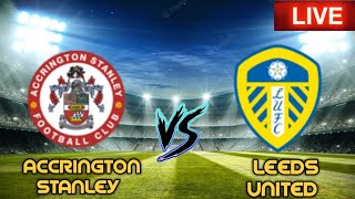 Accrington Stanley Vs Leeds United Live Football Match FA C