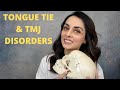 Tongue Tie & TMJ Disorders - Priya Mistry, DDS (the TMJ doc) #tonguetie #tmjd #tmjdisorders