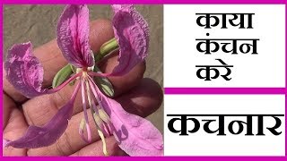 कचनार के फायदे  │ Benefits of Bauhinia Variegata, Kachnar By Vishal Sathye