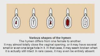 All Comments On Sexology: The Hymen - Myths And Misconceptions - YouTube