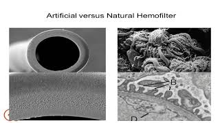 Emerging Innovation in Kidney Disease with Global Implications: Bioartificial Kidney