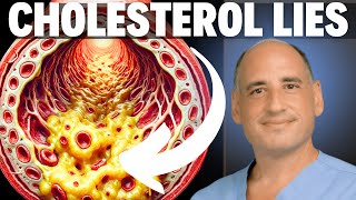 Top Doctors Share the TRUTH About Cholesterol (\u0026 Carnivore Diet)