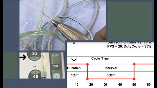 The Phaco Power modulation - Understand and Harness its power