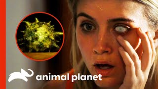 Contact Lens Parasite Almost Blinds Woman | Monsters Inside Me