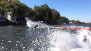 Allentown Periodontist Dr. John Potter Slalom Waterskiing Schuylkill River in Philadelphia