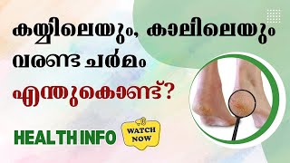 കയ്യിലേയും, കാലിലെയും വരണ്ട ചർമം എന്തുകൊണ്ട് ?  #dryskin