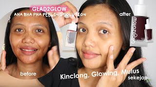 Glowing Mulus Sekejap? Eksfoliasi pakai Glad2Glow AHA BHA PHA Peeling Solutions