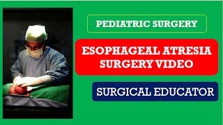 Esophageal Atresia with TEF  Surgery video