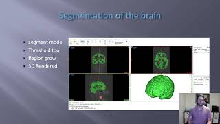 BME 301 Brain