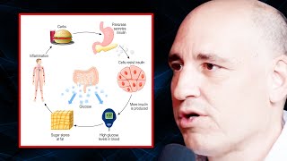 How to GET RID of Insulin Resistance Once and for All | Dr. Philip Ovadia