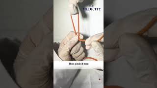 Laparoscopic Roeder's Knot