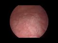 diagnostic cystoscopy how to perform