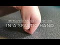 How to address hand spasticity