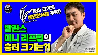 [더라인TV]발란스 미니 리프팅의 흉터 크기는 어떤가요?