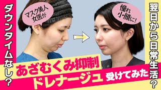 【小顔脂肪吸引受けてみた】翌日から働けた！あざむくみ抑制ドレナージュを受けた女医のリアルAFTERを公開【マスク美人女医の二重あごを吸いました】