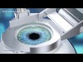 LASIK Treatment Animation