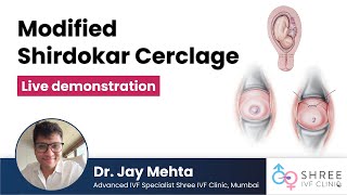 Modified Shirodkar Cerclage (Live demonstration) | Dr Jay Mehta | Surgery for Os Tightening