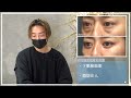 【よくわかる　くま取り 下眼瞼脱脂、脂肪注入 症例解説】bianca clinic