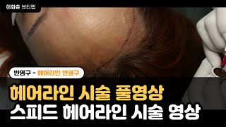 #헤어라인시술 #헤어라인시술풀영상 #반영구교육 #헤어라인교육