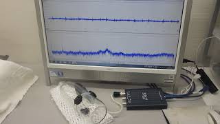 メガヘルツの超音波発振制御プローブを製造する技術ーー基礎実験ーー（超音波システム研究所）