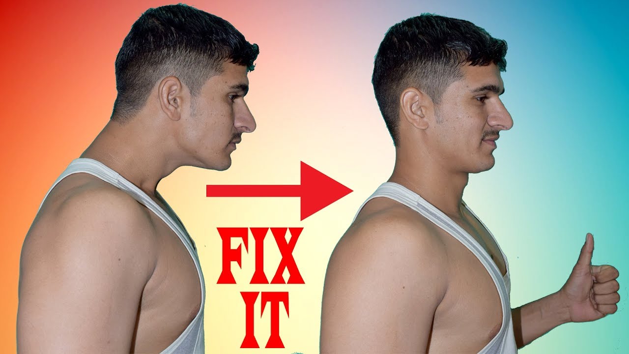 How To Fix Forward Head Posture Youtube