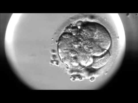 What is the size of a human zygote?