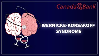 Wernicke Korsakoff Syndrome