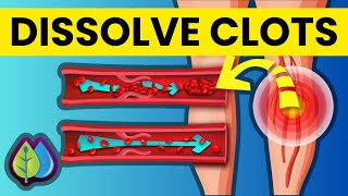 8 Nutrients You Need to Dissolve Blood Clots Now!