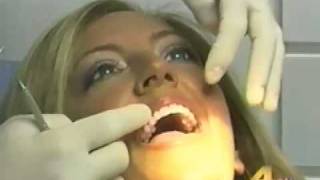 How To Pick Your Cosmetic Dentist, Dr. Jack Ringer on NBC