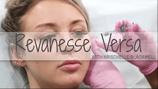 Revanesse Versa with Krishcelle Blackwell | Rejuvenate Medical Spa in Encino, CA