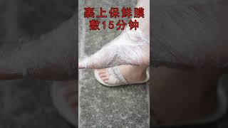 家里有人手脚干裂脱皮，用尿素霜，还你健康皮肤#尿素霜#国货之光