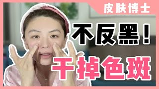 【德国博士】不看后悔‼有斑姐妹福音😎脸蛋子干干净净