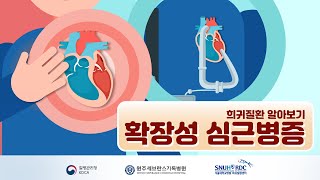 [희귀질환 바로알기] 확장성 심근병증