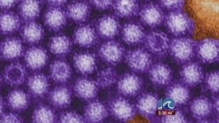 CDC says norovirus could be next super bug