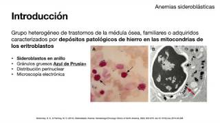 Anemias sideroblasticas