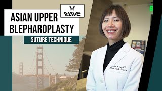 Dr. Wong discusses the Suture Technique for Upper Blepharoplasty | Wave Plastic Surgery