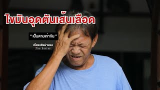 ไขมันอุดตันเส้นเลือด I เรื่องจริงผ่านจอ Theseries 24 มีนาคม 2567