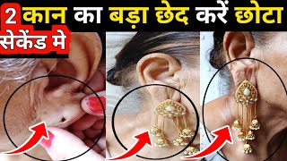 10 सेकेंड मे कान का बड़ा छेद करें छोटा 👀 How To Reduce Ear Hole Size / tips