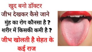 Know What Your Tongue Says about Your Health | अपनी जीभ देखकर सेहत की कैसे करें जांच पता करें